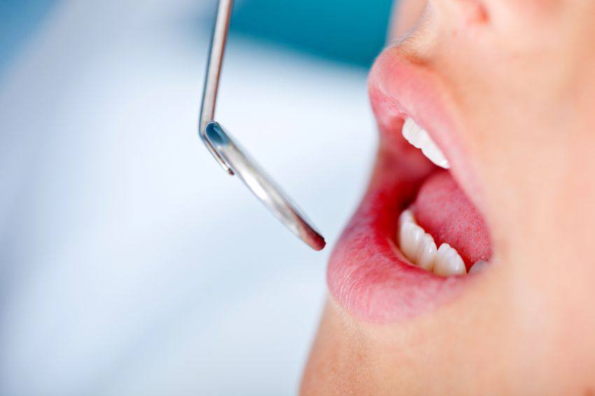 A dentist patient opening their mouth for a mirror